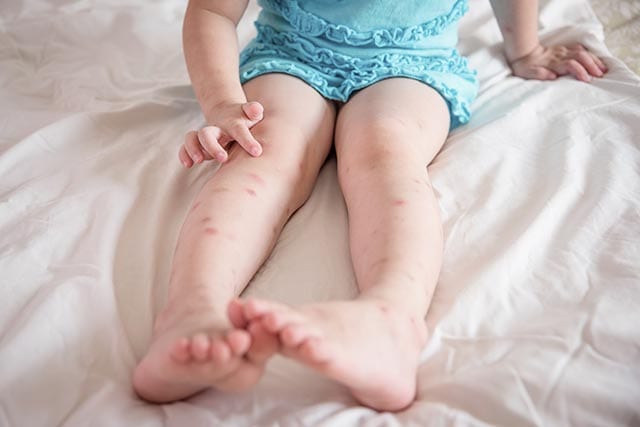 Pršice v postelji lahko povzročijo alergije na pršice, izpuščaje in druge bolezni, predvsem pri otrocih